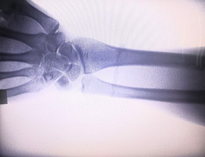 Clear perspective of palms and arms Clear perspective of palms and arms